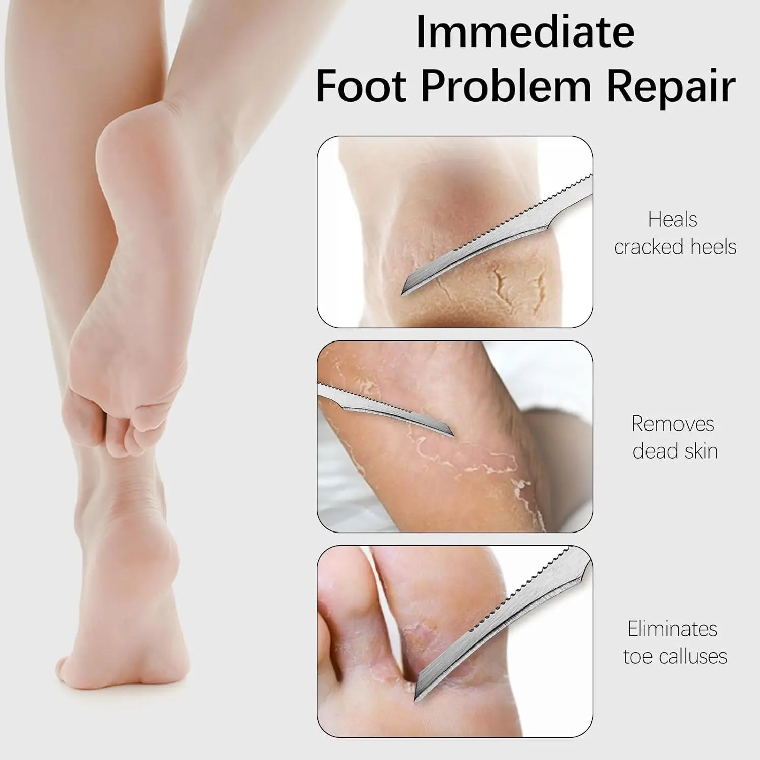 1pc Manicure Pedicure Tools Toe Nail Shaver Feet Pedicure Knife Kit Foot Callus Rasp File Dead Skin Remover Foot Care Tools